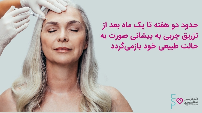 ماندگاری تزریق چربی پیشانی